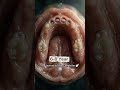 Human's teeth evolution