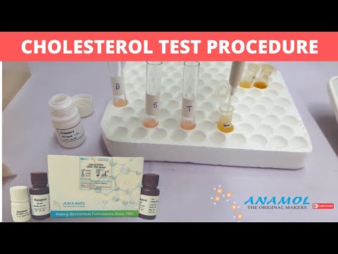 ვიდეო: როგორ მოვემზადოთ ქოლესტერინის ტესტისთვის: 10 ნაბიჯი (სურათებით)