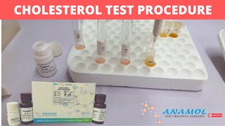 CHOLESTEROL Test Procedure | CHOLESTEROL Reagent | Procedure for performing CHOLESTEROL Reagent Test