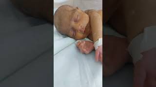 observation of newborn baby