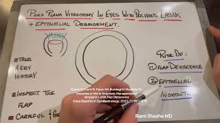 Pars plana vitrectomy, epithelial debridement and previous LASIK
