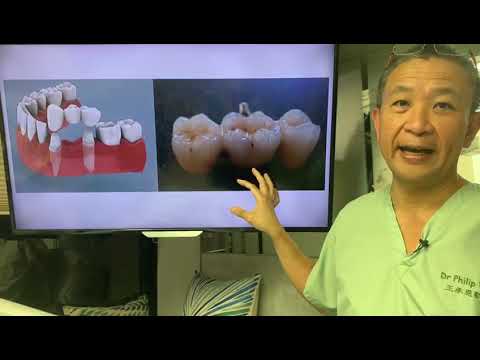 我的事務所@新城財經台 鑲牙選項（二） fm104 phoneshow