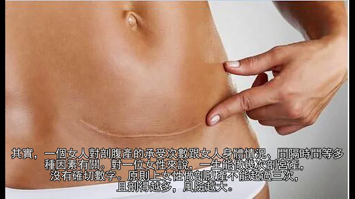 女人一輩子，能承受幾次剖腹產，看完好心疼 - 天天要聞