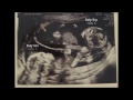 Smith twin pregnancy announcement compilation
