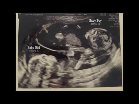 smith twin pregnancy announcement