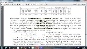 Matlab code for localization and segmentation of 3d intervertebral discs in mr images by data driven