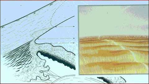 Full Lecture: Basic Gonioscopy