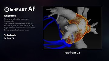 inHEART Models AF (Atrial Fibrillation)