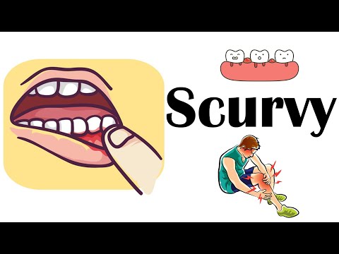 Video: Scurvy