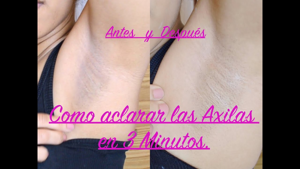 ¡Solucione sus axilas oscuras con un Dermatólogo!_3 Dermatologo para aclarar las axilas_3