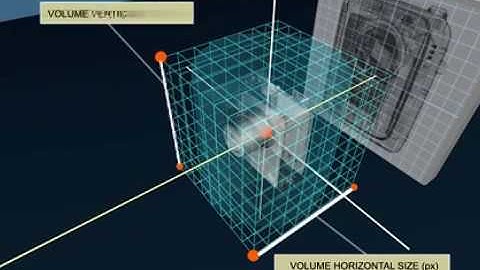 Cone Beam CT software package AVRG
