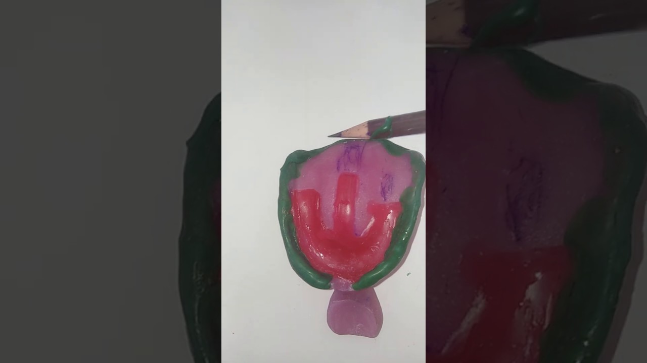 Visit 2Border moulding for an upper complete denture Evaluations for