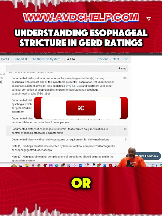 understanding-esophageal-structure-in-gerd-rating-youtube