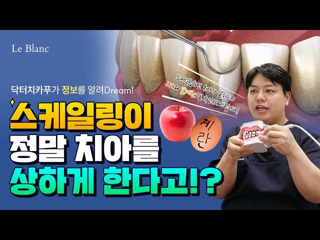 스케일링하면 이빨이 갈리진 않나요? 스케일링 계란🥚 사과🍎 팩트 체크!