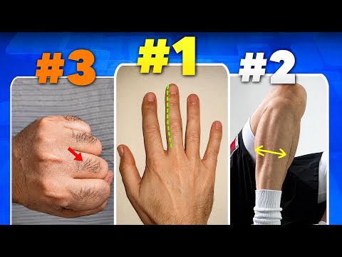 How To CHECK If Your Growth Plates Are Still OPEN! (Without X-ray)