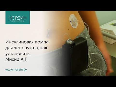 Видео: Инсулиновые помпы для людей с диабетом