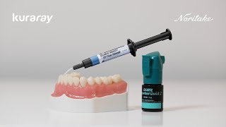 Direct restoration workflow | CLEARFIL Universal Bond Quick 2   ES Flow Universal (Low)