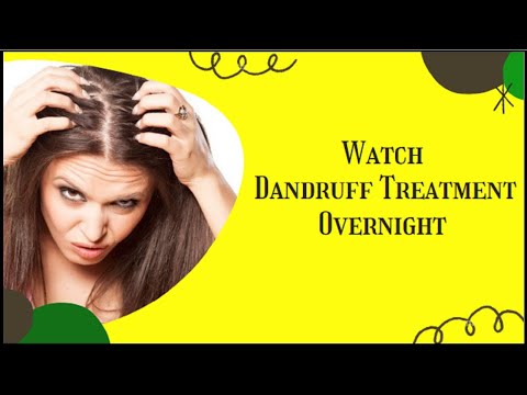 How To Get Rid Of Dandruff And Hair Fall | Seborrheic Dermatitis Scalp Treatment
