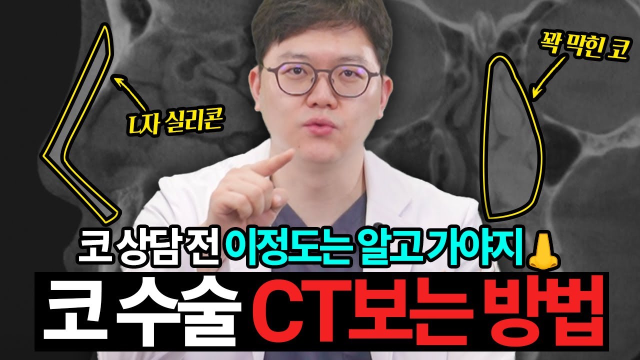 코 수술 전 꼭 보고가세요💥코 성형 CT보는 방법