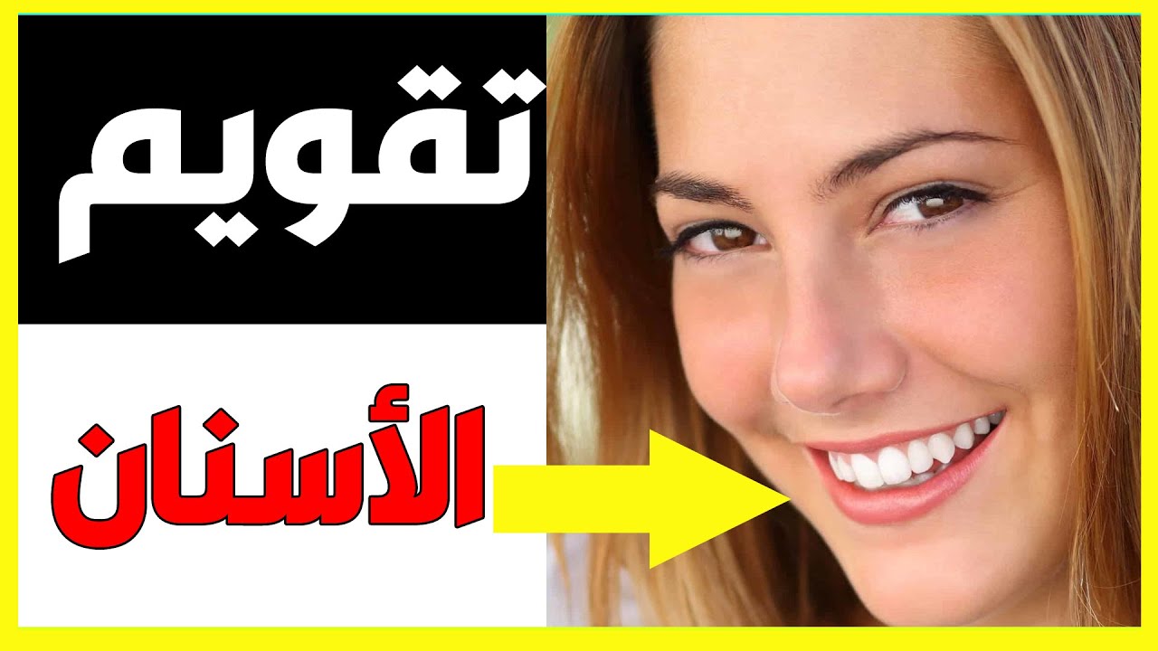 تقويم الاسنان بالليزر أحدث التقنيات والمميزات والأضرار مع دكتور احمد مرتضى Youtube