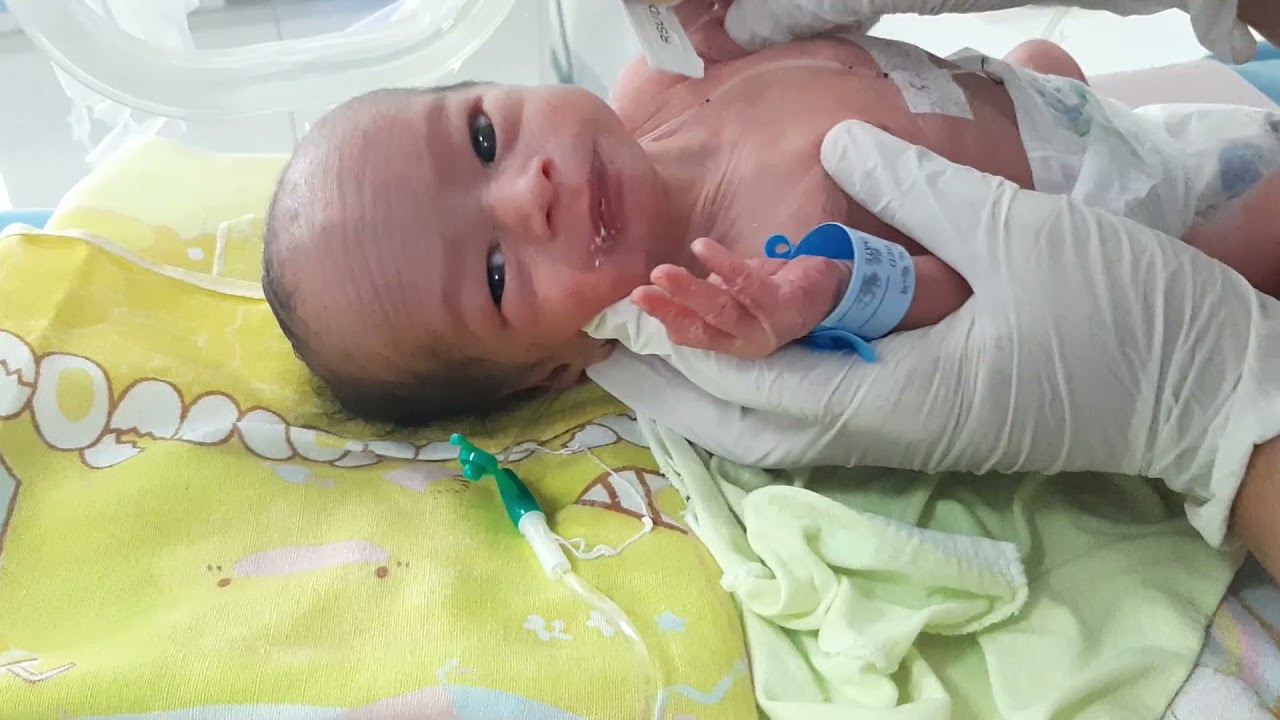 PEMERIKSAAN NEW BALLARD SCORE