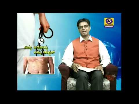 How to Treat the Long Psoriasis and How to get rid of It................in kannada. How to Treat the Long Psoriasis and How to get rid of It................in kannada.