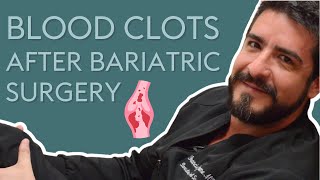 Are Blood Clots a Risk after Bariatric Surgery?