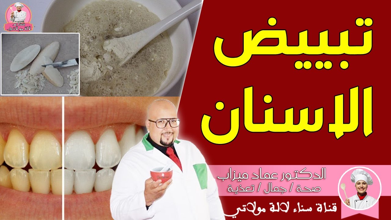 وصفة لتبييض الاسنان من عند الدكتور عماد ميزاب