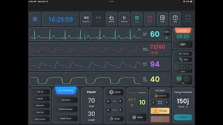 DART Sim Pro: Complete Walkthrough of the Ultimate ECG & Defibrillator Simulator for ACLS Training screenshot 3