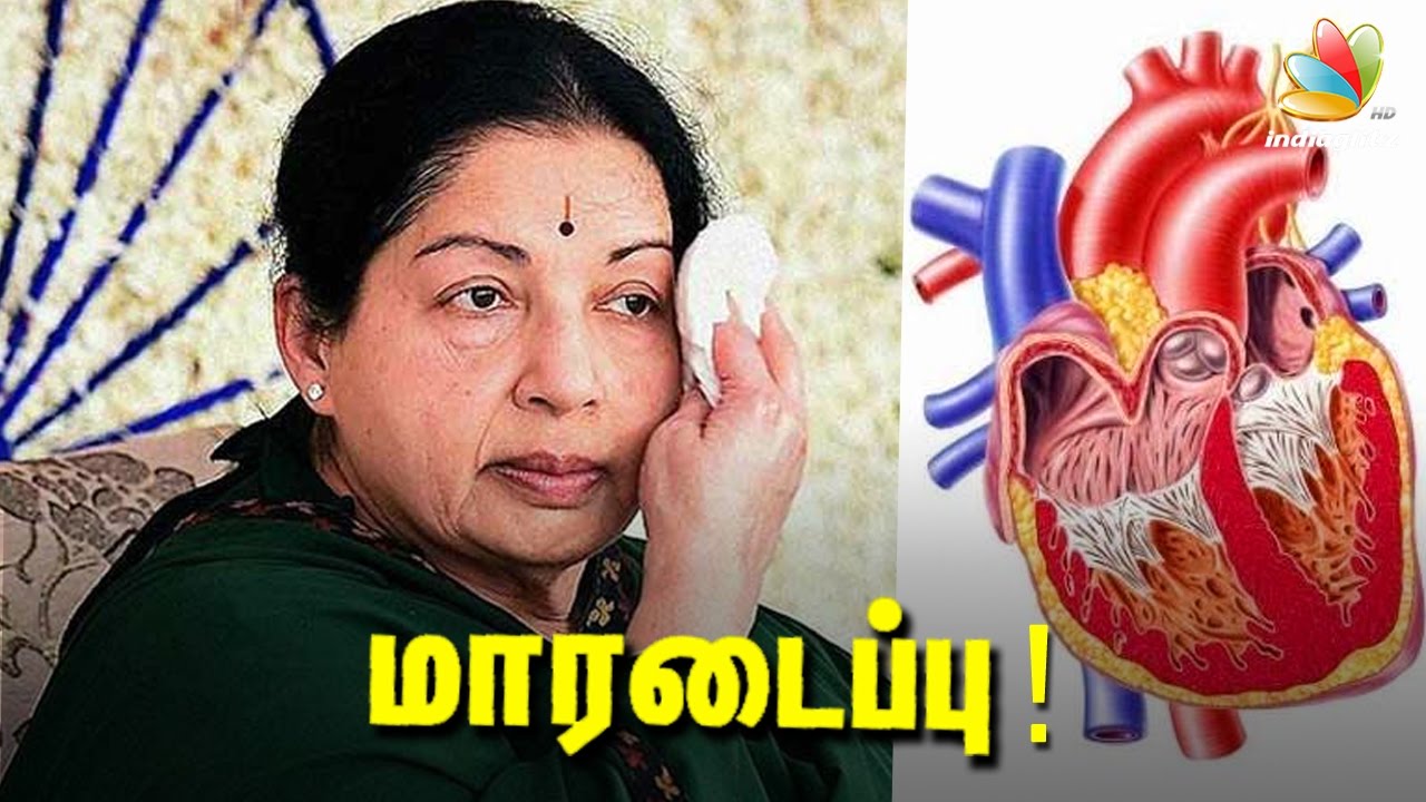 Jayalalitha Heart Attack details : Apollo Hospital Coverage | Health Update