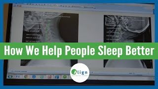 A Case Study on Sleep and the Spinal Cervical Curve