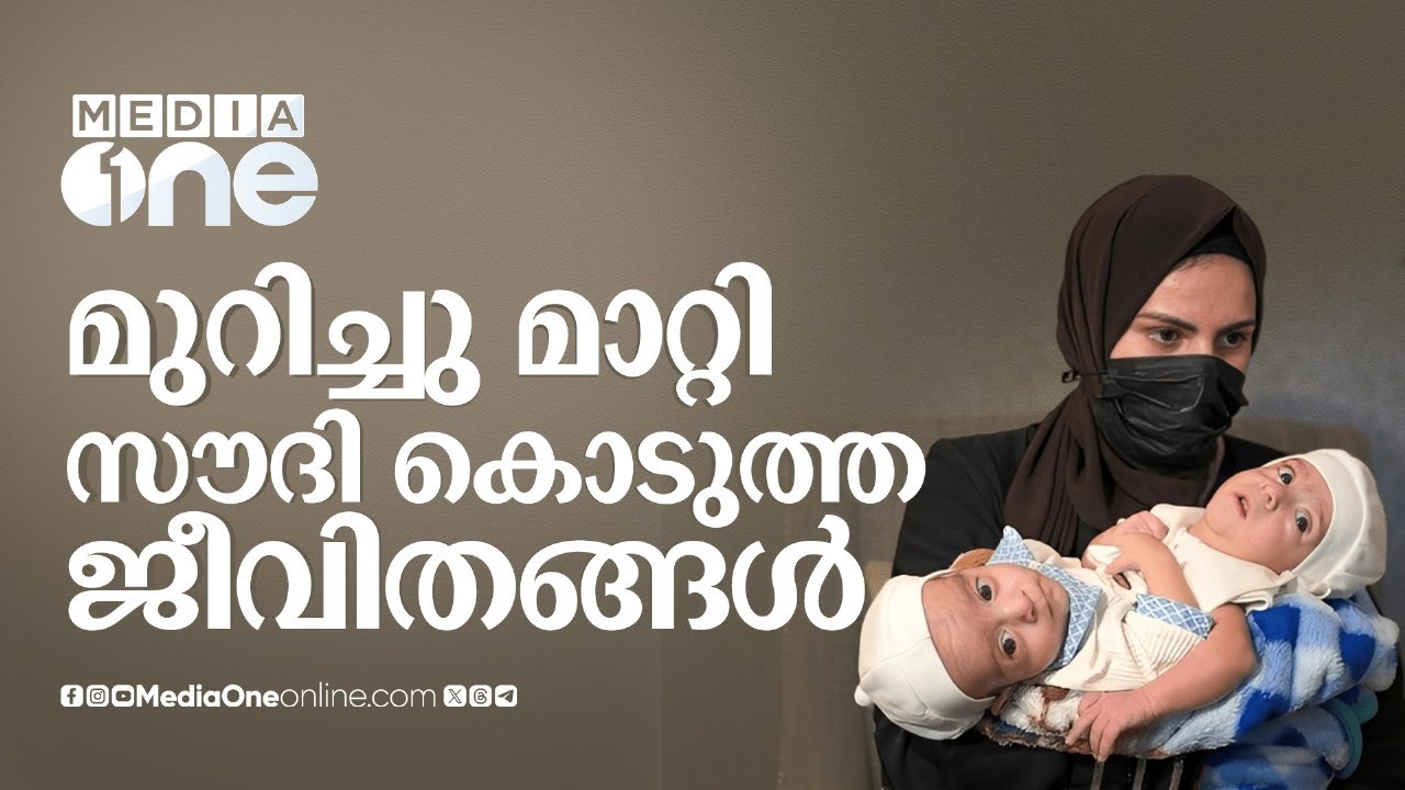 ലോകത്ത് എവിടെയാണേലും സൗദി വിമാനം അവരെ തേടിയെത്തും | Saudi Free Siamese Surgery History | Saudi Story