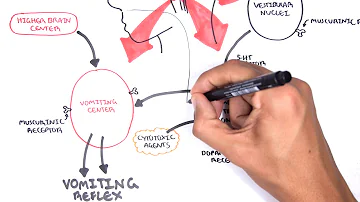 What is vomiting a symptom of?