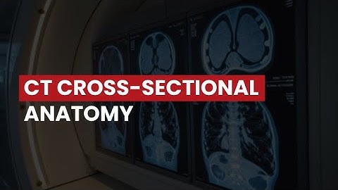 CT Cross-Sectional Anatomy of the Thorax, Abdomen, and Pelvis REPLAY