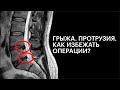 Грыжа, Протрузия? Cordus избавляет от операции в 94% случаев