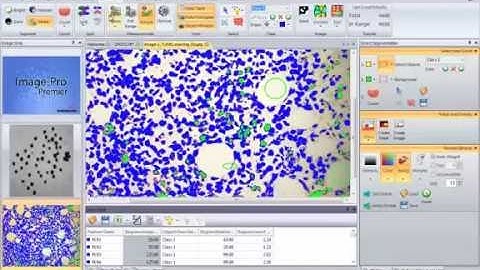 Image-Pro Premier - Automatically Count and Measure Objects