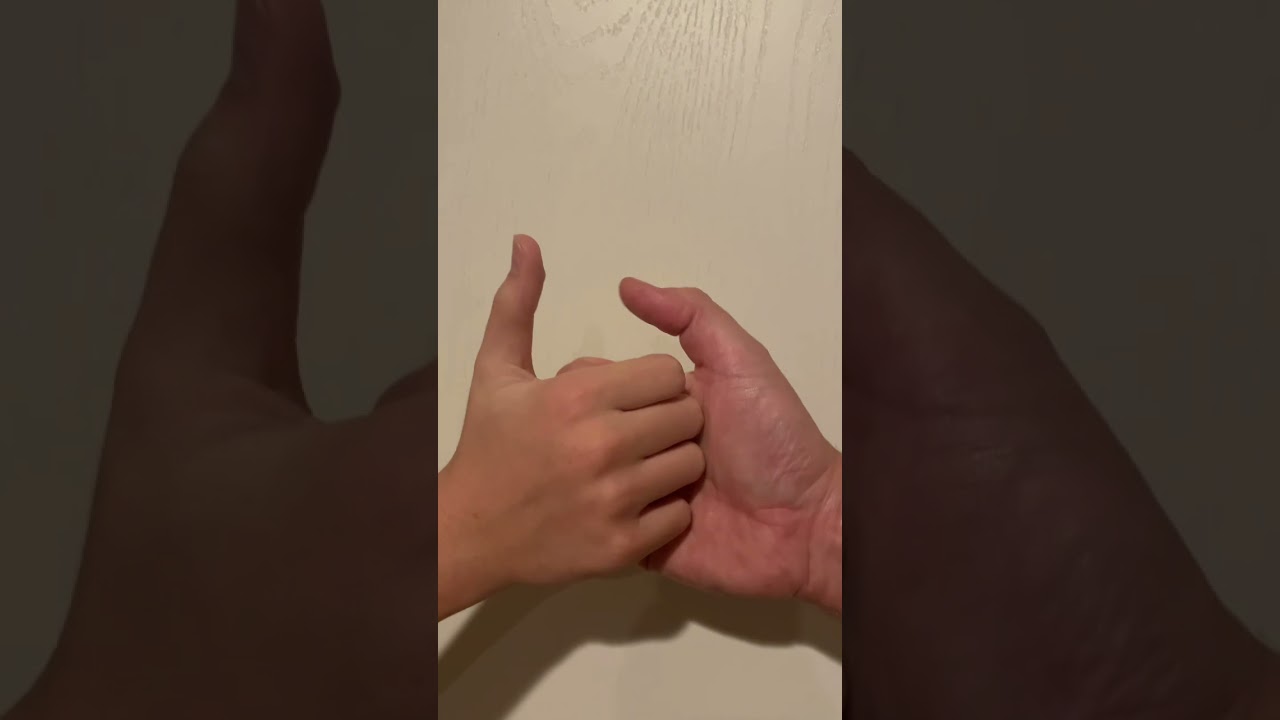 Double Jointed Thumb Wrestling 