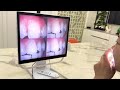 High-Definition Intraoral Camera Solution Specialist: Seamless Dental Imaging and Hygiene Demo
