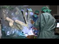 Robot chirurgical  hpital robert schuman
