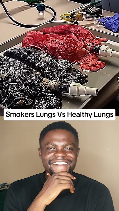 This Is What Smoking Does to Your Lungs…💀#shorts