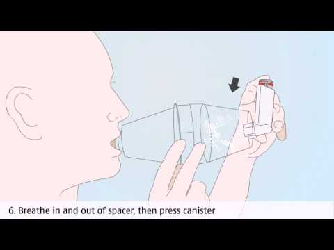 Asthma treatment: how to use a metered-dose inhaler (multiple breath) with a spacer