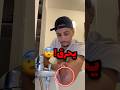 حط يده في الموية وهوا مصاب من الاساس وراحت عليه!!