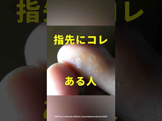 両手とも爪がなくなる！？