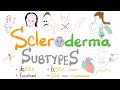 Scleroderma Subtypes (5 Types of Systemic Sclerosis)