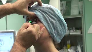 Axsys In Action - Toric Marking Device