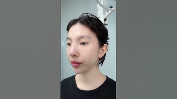 Bác sĩ Thái  cứu chiếc mũi sắp bị lộ của em gái làm tại nơi khác