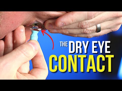 Video: Virker sklerale linser til tørre øjne?