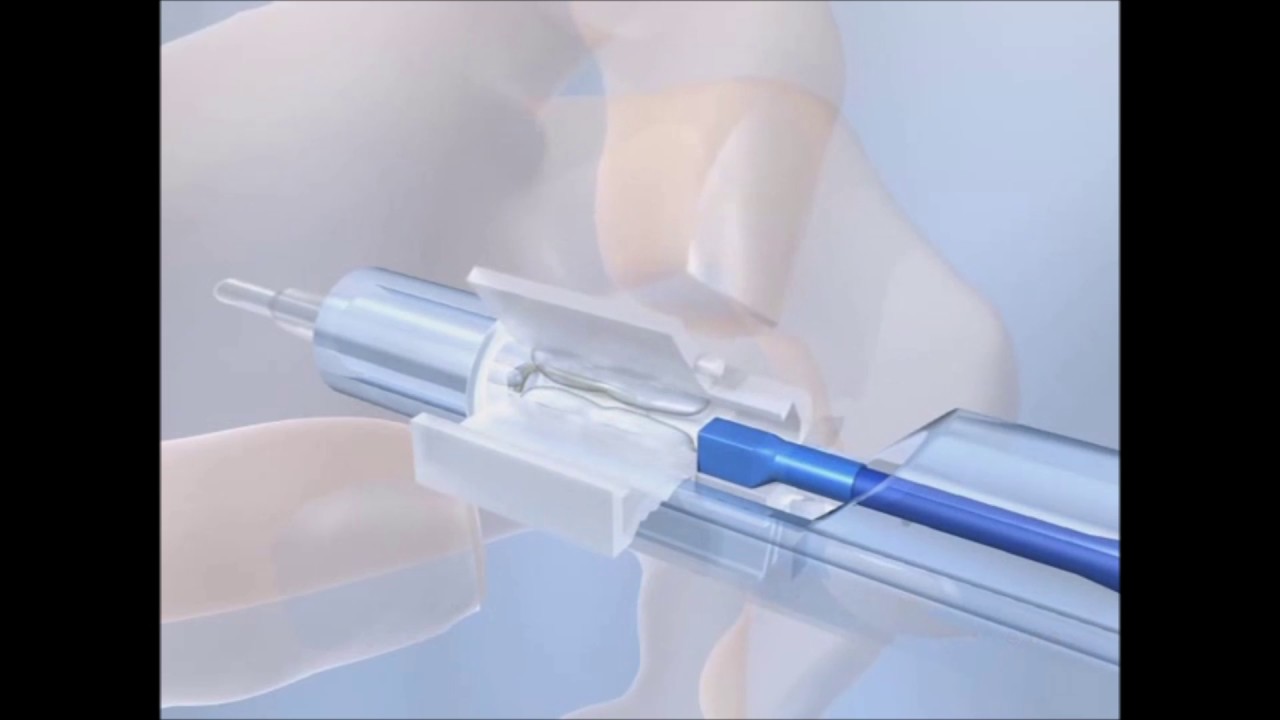 Accuject Injection - YouTube