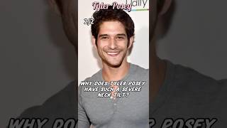 Why does Tyler Posey have such a severe neck tilt?#TylerPosey#shortvideo#shorts