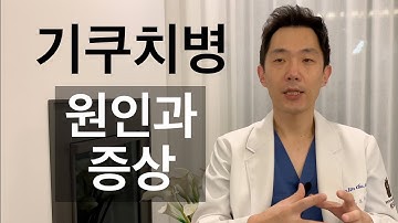 [임파선#18] 목 임파선염 - 기쿠치병(기꾸찌병)의 원인과 증상에 대하여